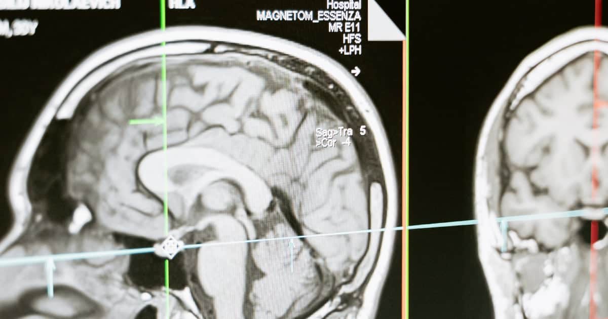 About CBD Effects Image